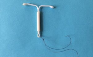 An IUD or birth control with fibroids can help heavy periods