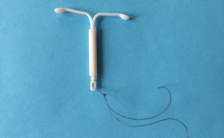Intrauterine Device Image