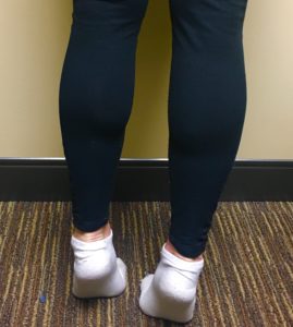 calf raise exercise for ulcers