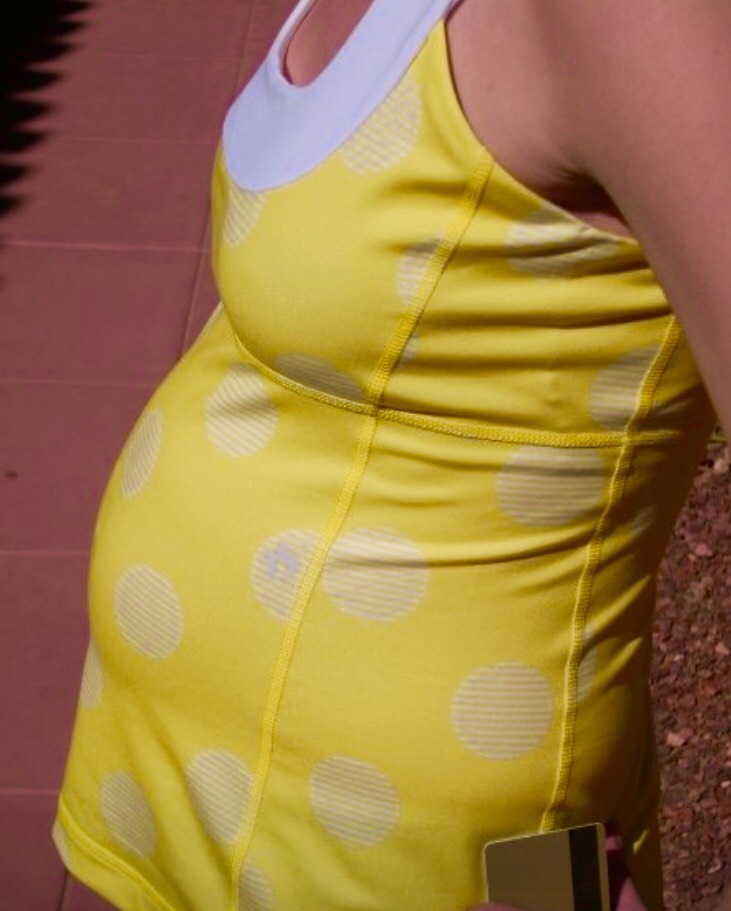 A Pregnant Woman During Fibroids