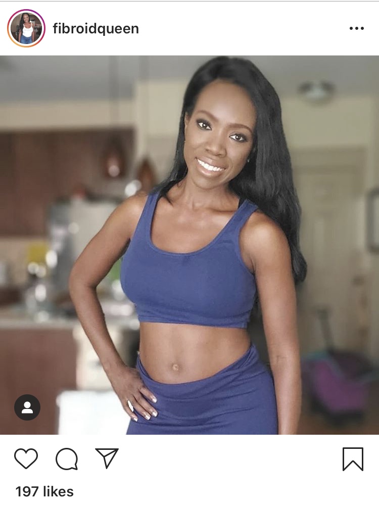 black women and fibroids