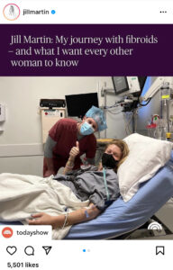 Jill Martin fibroids cause back pain