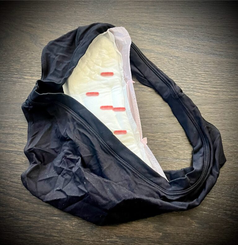 Fibroid-related discharge